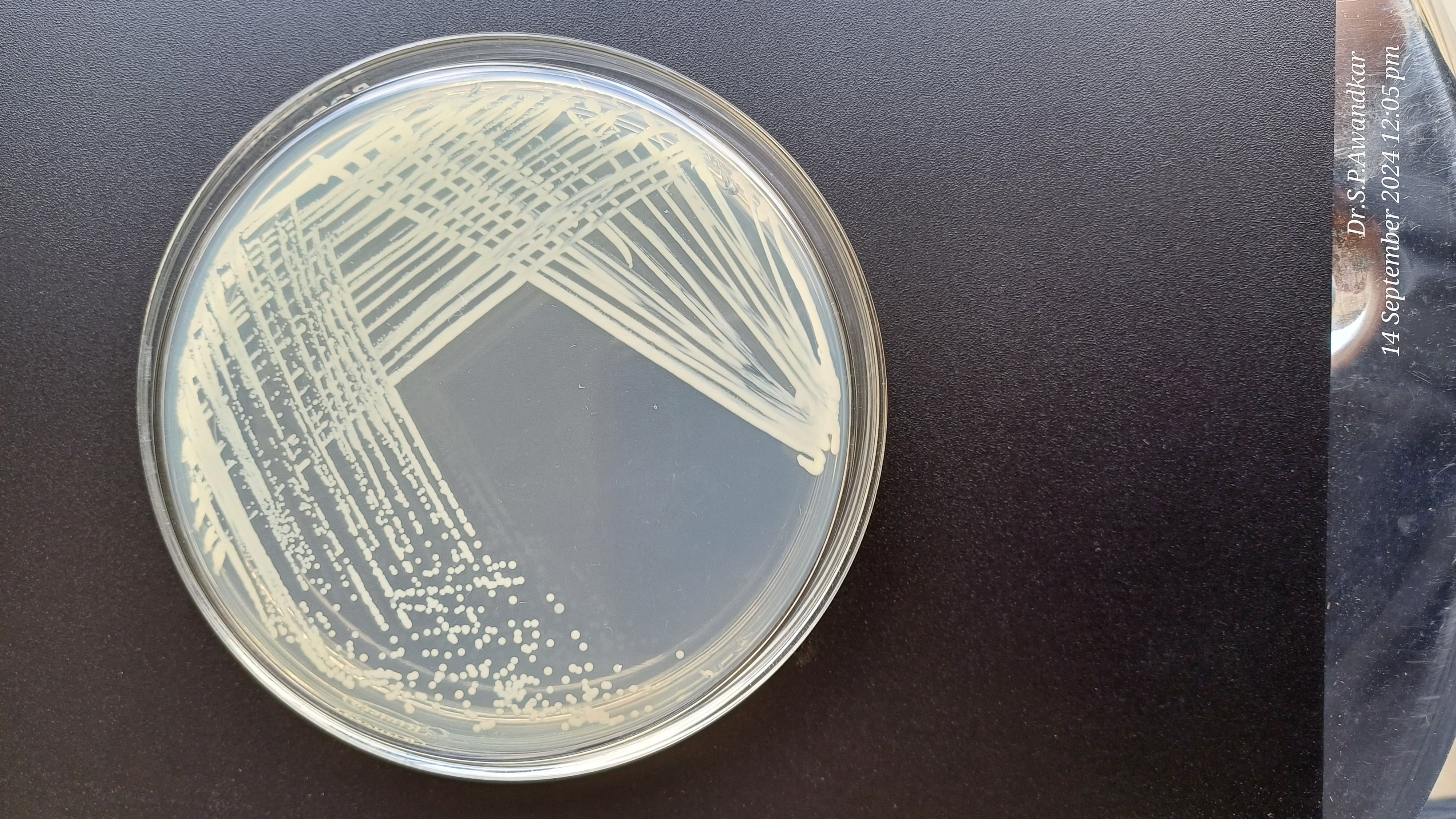 15. Diplococci Spp.